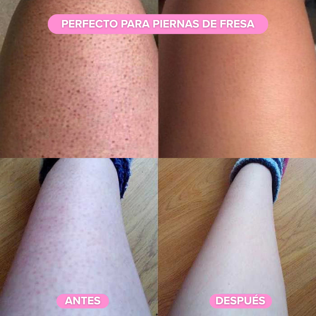 Depiladora Nuvella®