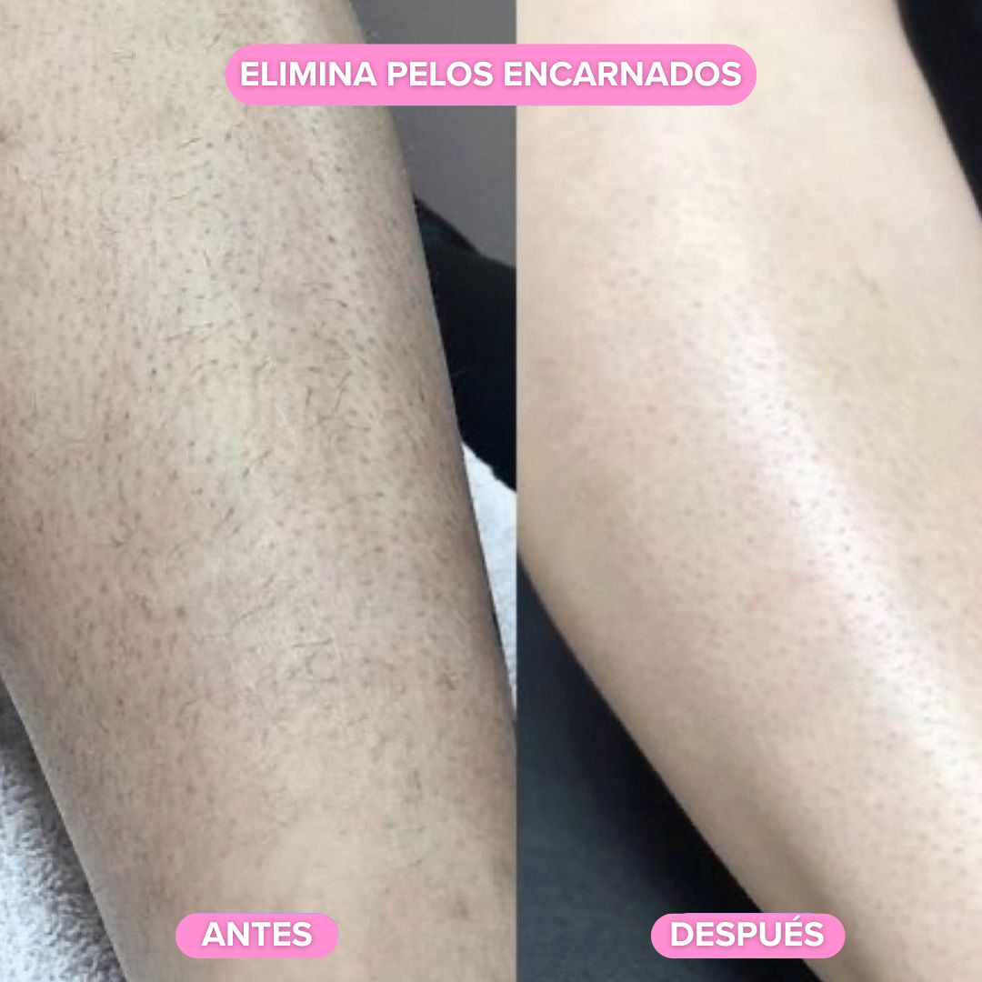 Depiladora Nuvella®